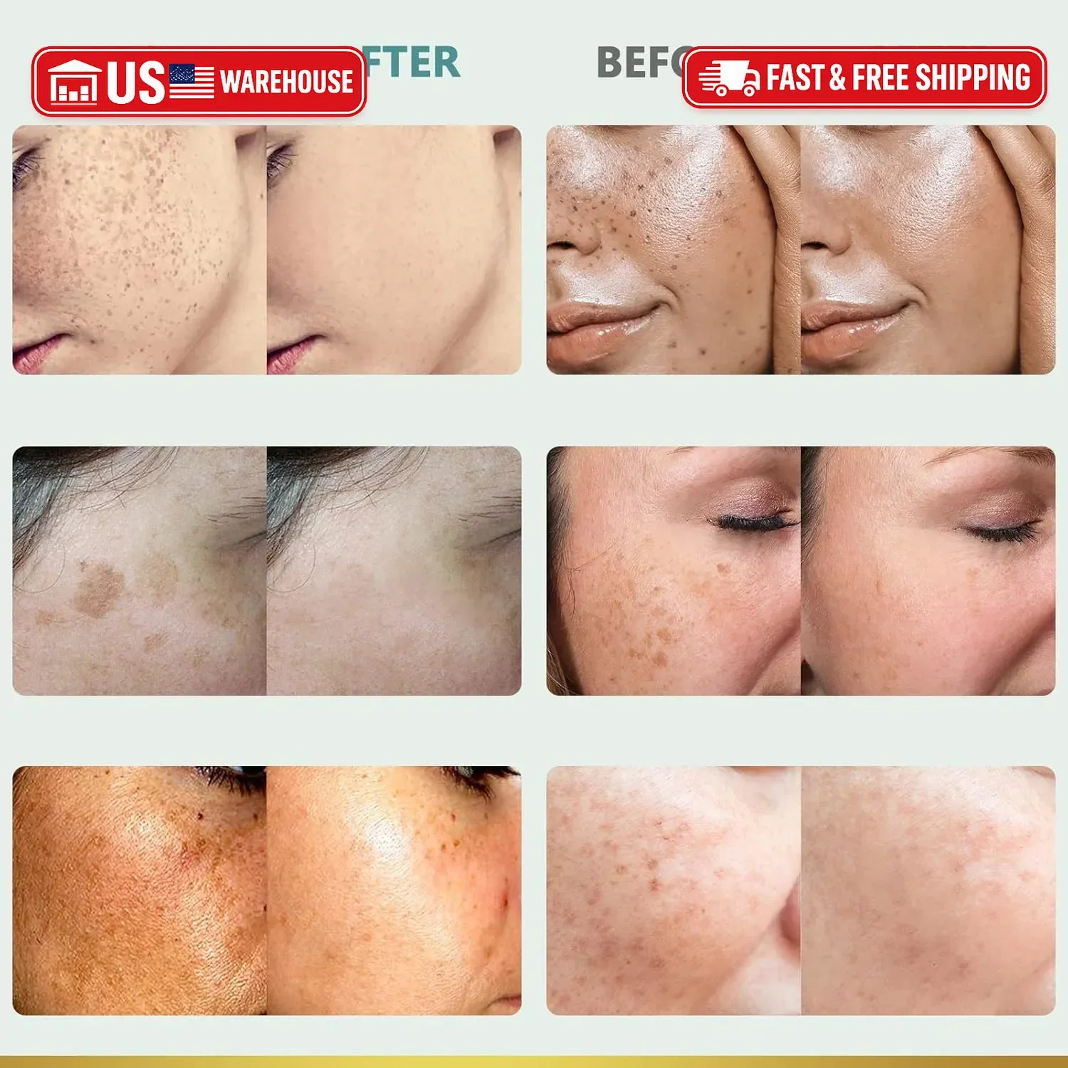 CITYGOO Dark Spot Remover for Face: Dark Spot Corrector Cream – Enriching Skin C