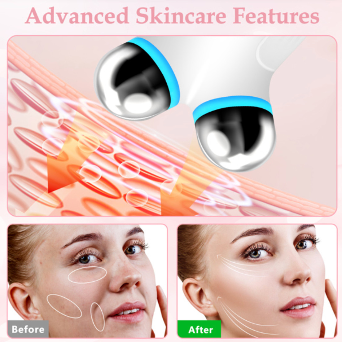 EMS Facial Massager Face Lift Device Anti Wrinkle Skin Tightening Beauty Tool US