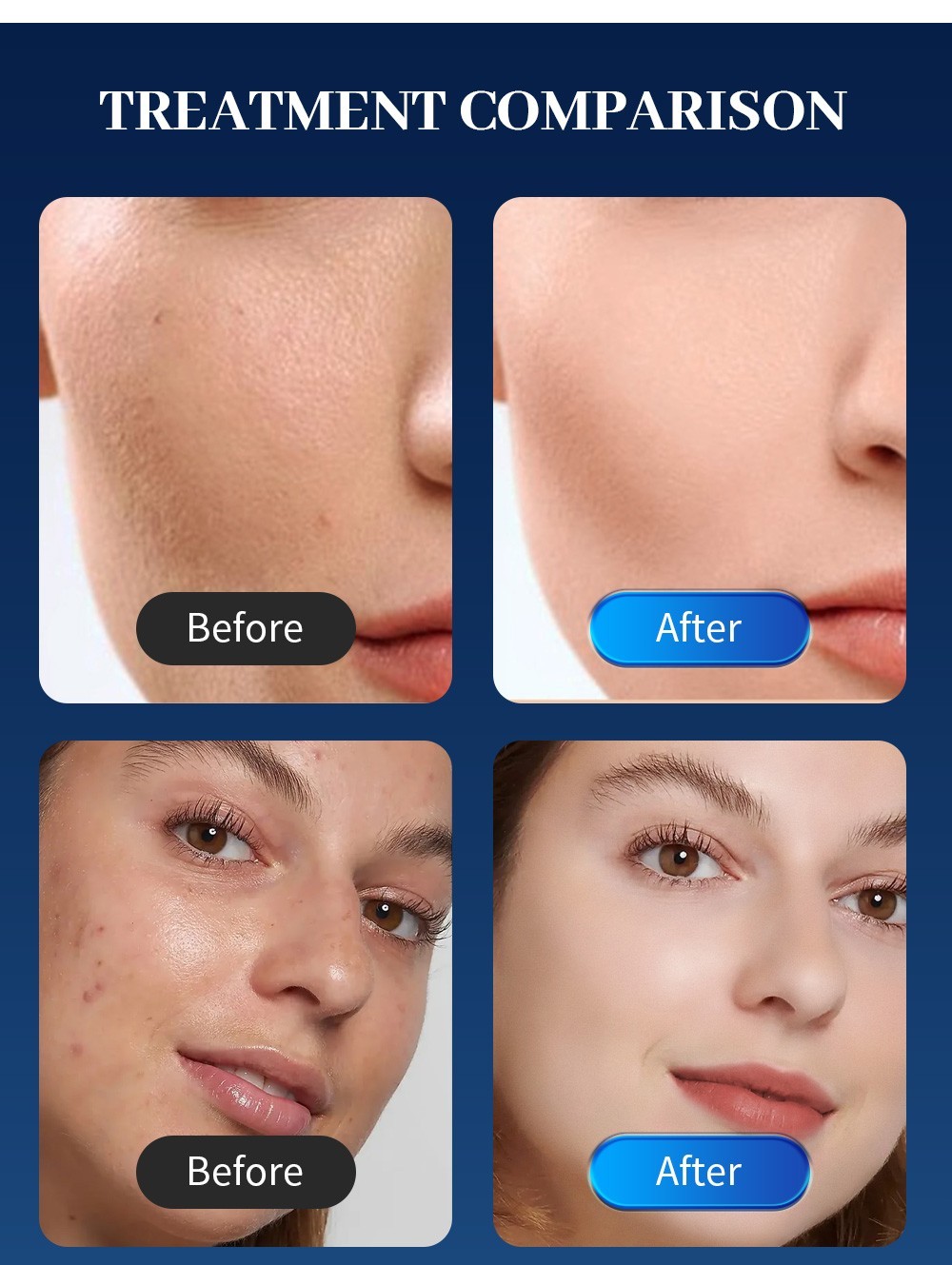 3 IN 1 Fractional Face Lifting Body Tightening Skin Rejuvenation Machine