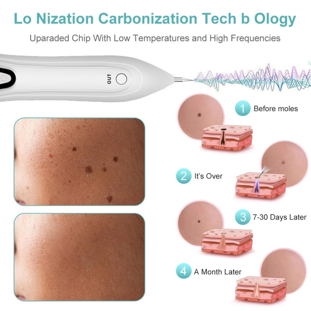 Electric Laser Plasma Pen Mole Removal Dark Spot Remover Skin Wart Tag Tattoo US