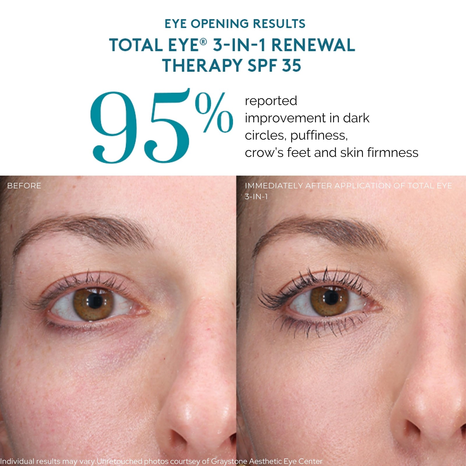 Colorescience Total Eye 3-in-1 Renewal Therapy, 0.23 fl. oz. – Medium