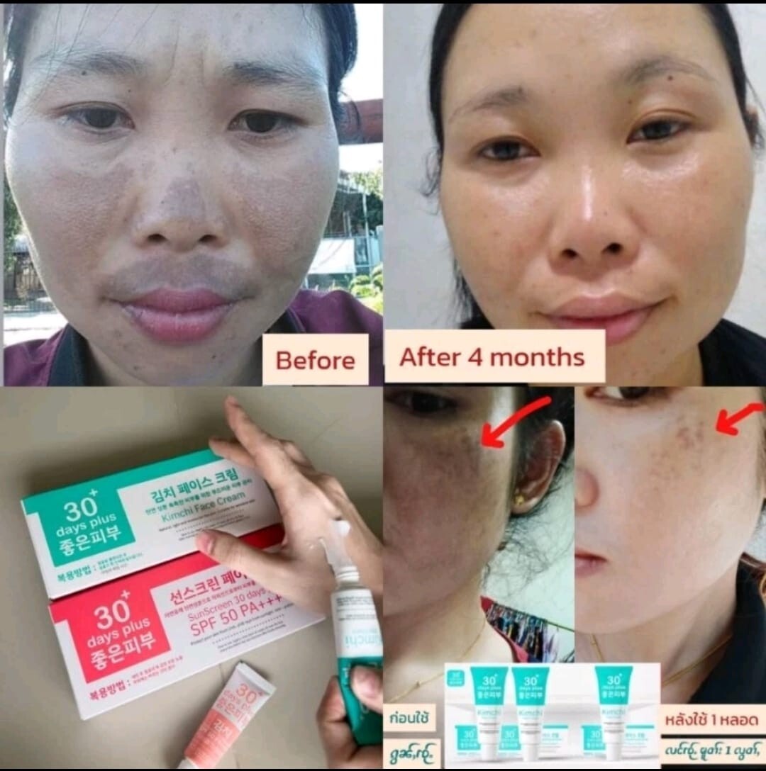 1 SET KIMCHI (EXP: 10/25,01/26) FACECREAM 30 DAYS PLUS + SUN SCREEN SPF50 PA+++