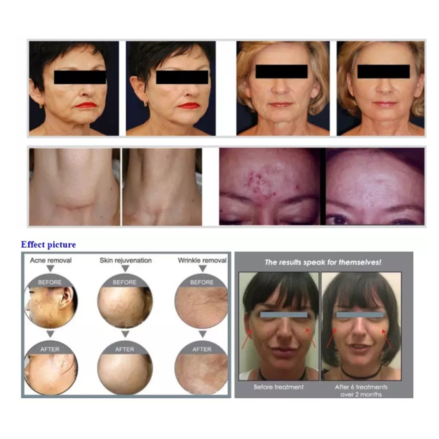 Professional 7 Colors LED Photon Photodynamic Light Therapy PDT Beauty Machine