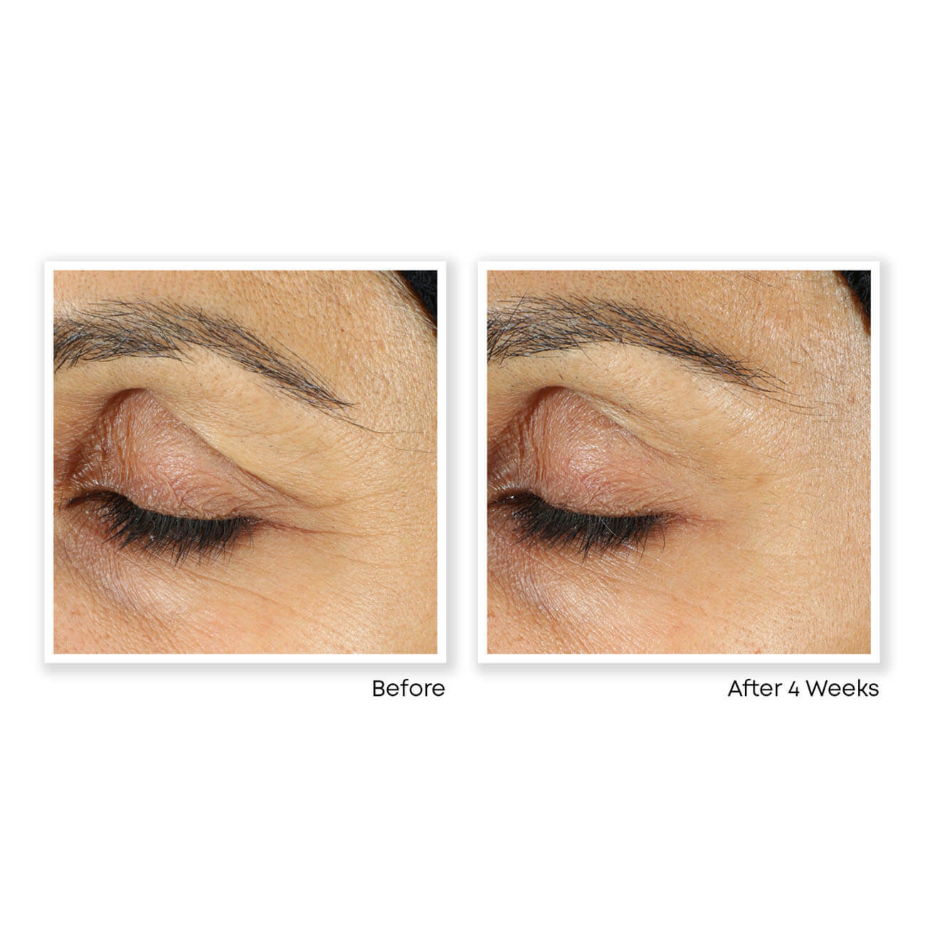 Anti-Aging Retinol Vitamin A 2.5% TURN BACK THE CLOCK Facial Face Serum Cream