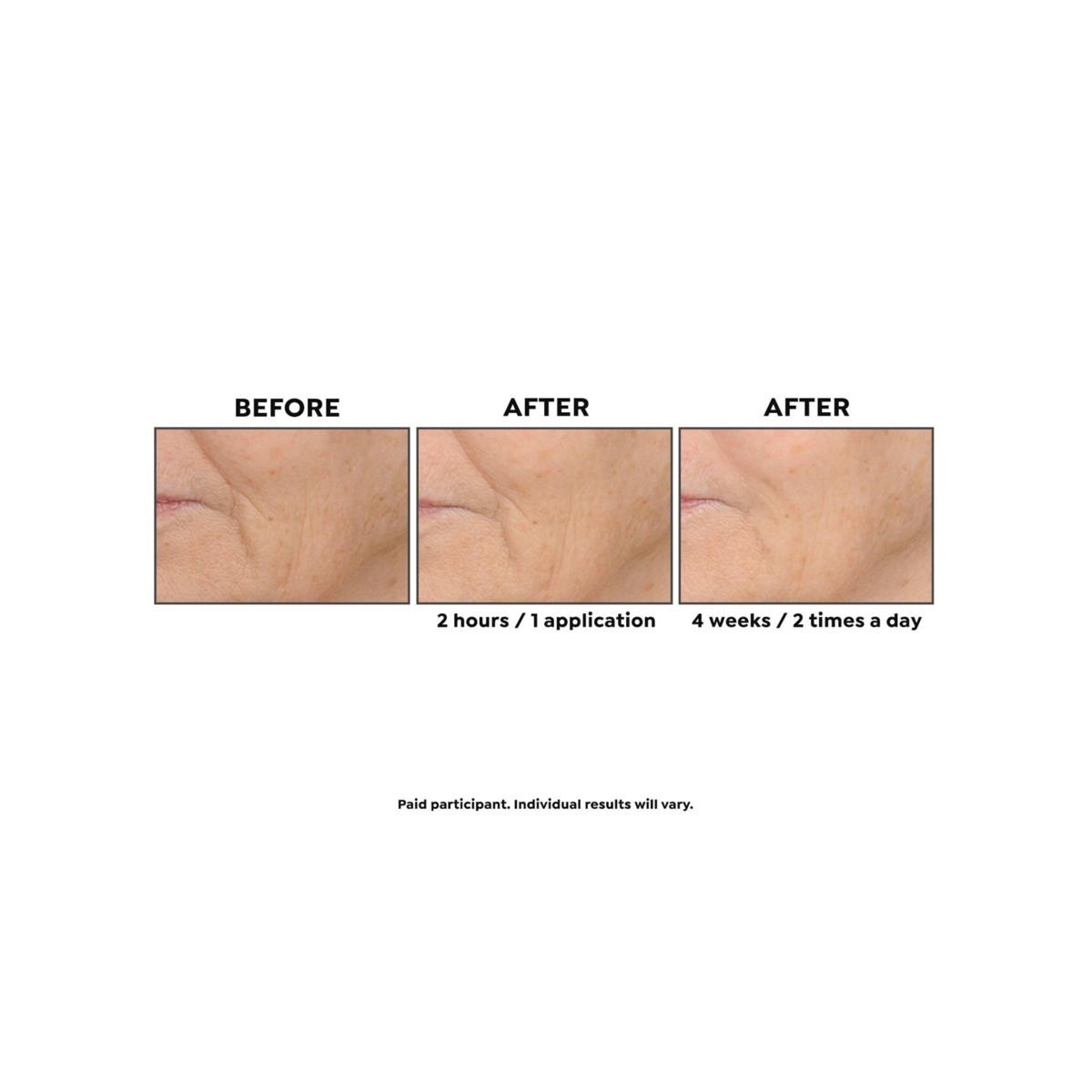 #Perlier Black Rice Triple-Size Hyaluronic Acid Gel—1.6 fl. oz.