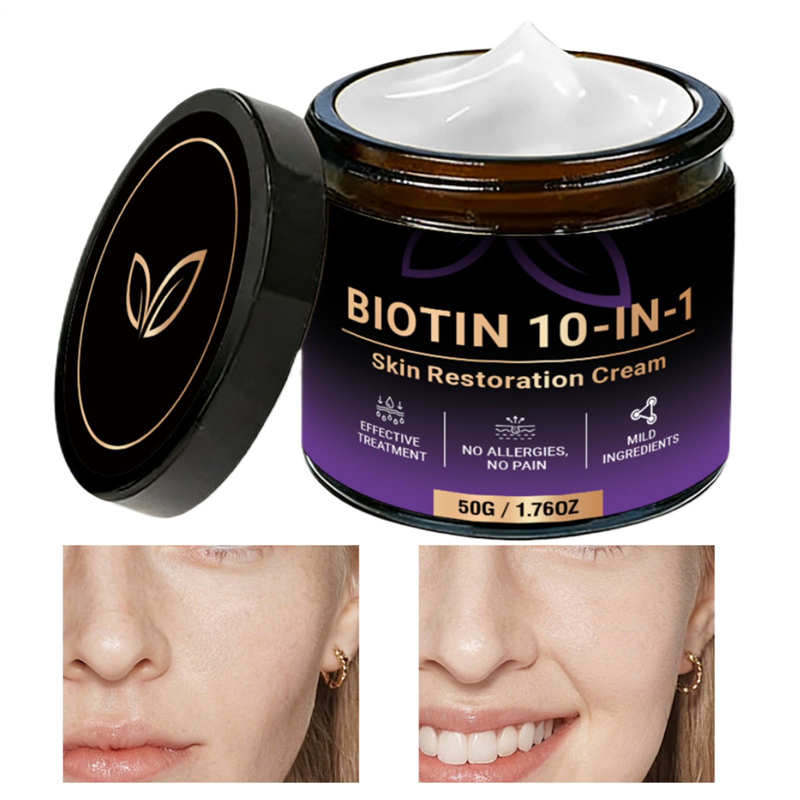 Evolvion Biotin 10-in-1 Skin Restoration Moisturizing Cream, 2026 New Skin Treat