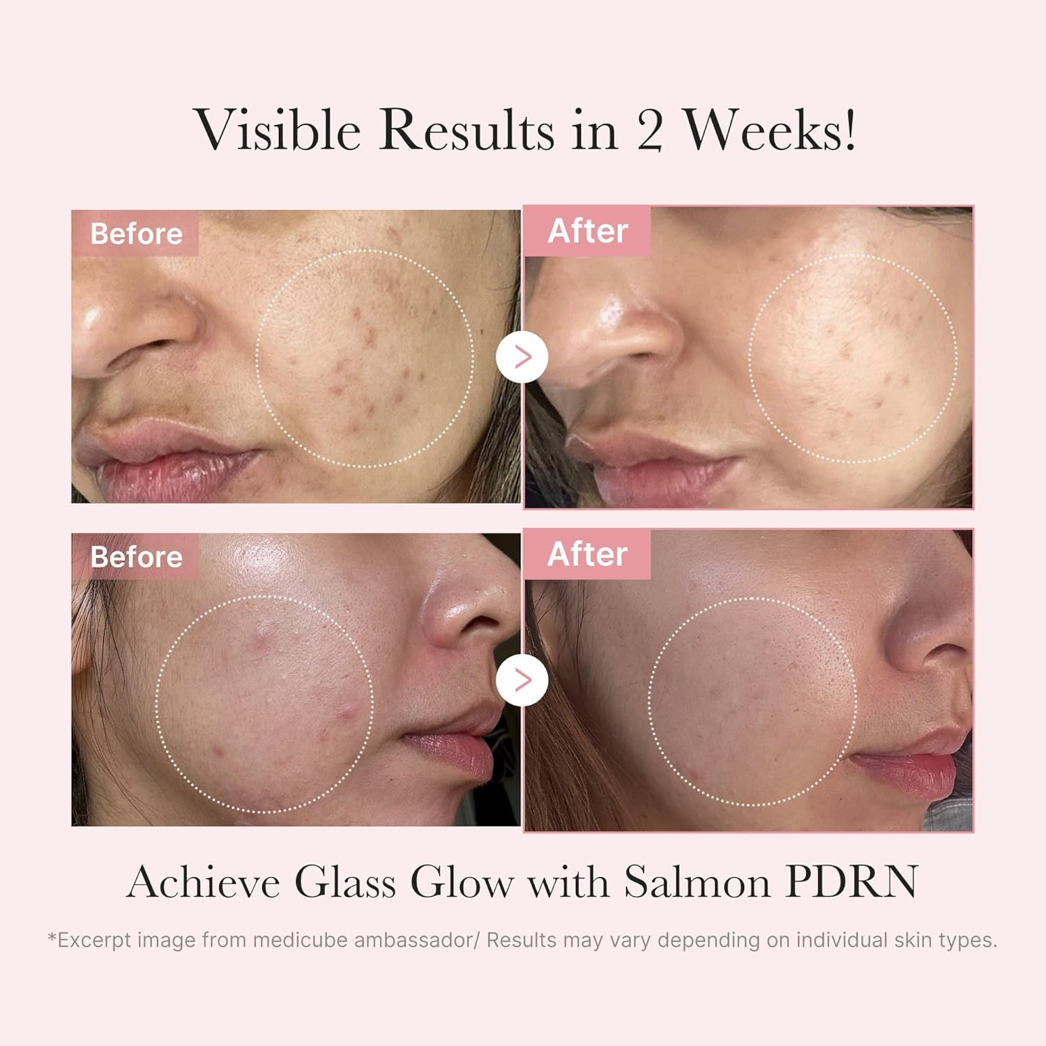 Salmon DNA PDRN Trial Kit | Glass Glow Mini Skincare Set with Toner, Serum & She