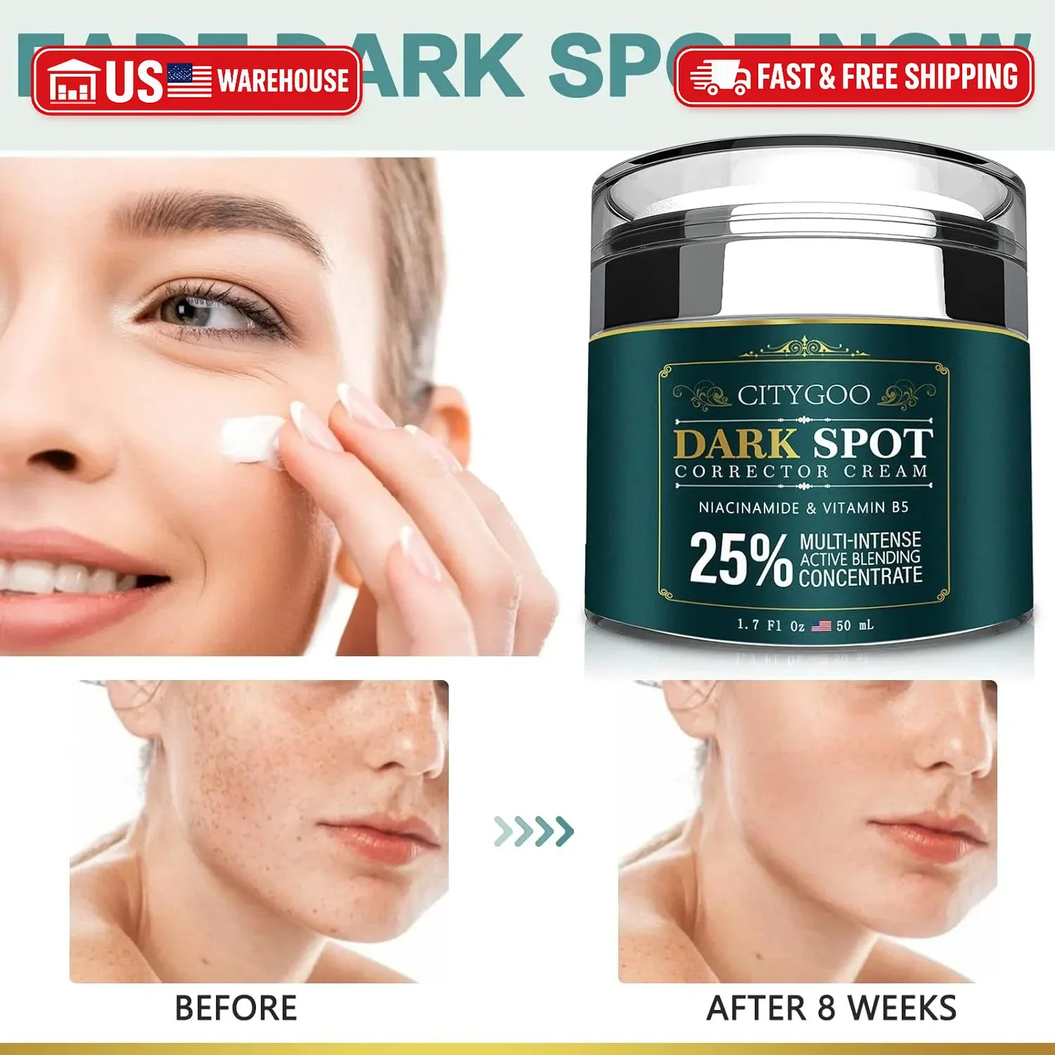 CITYGOO Dark Spot Remover for Face: Dark Spot Corrector Cream – Enriching Skin C