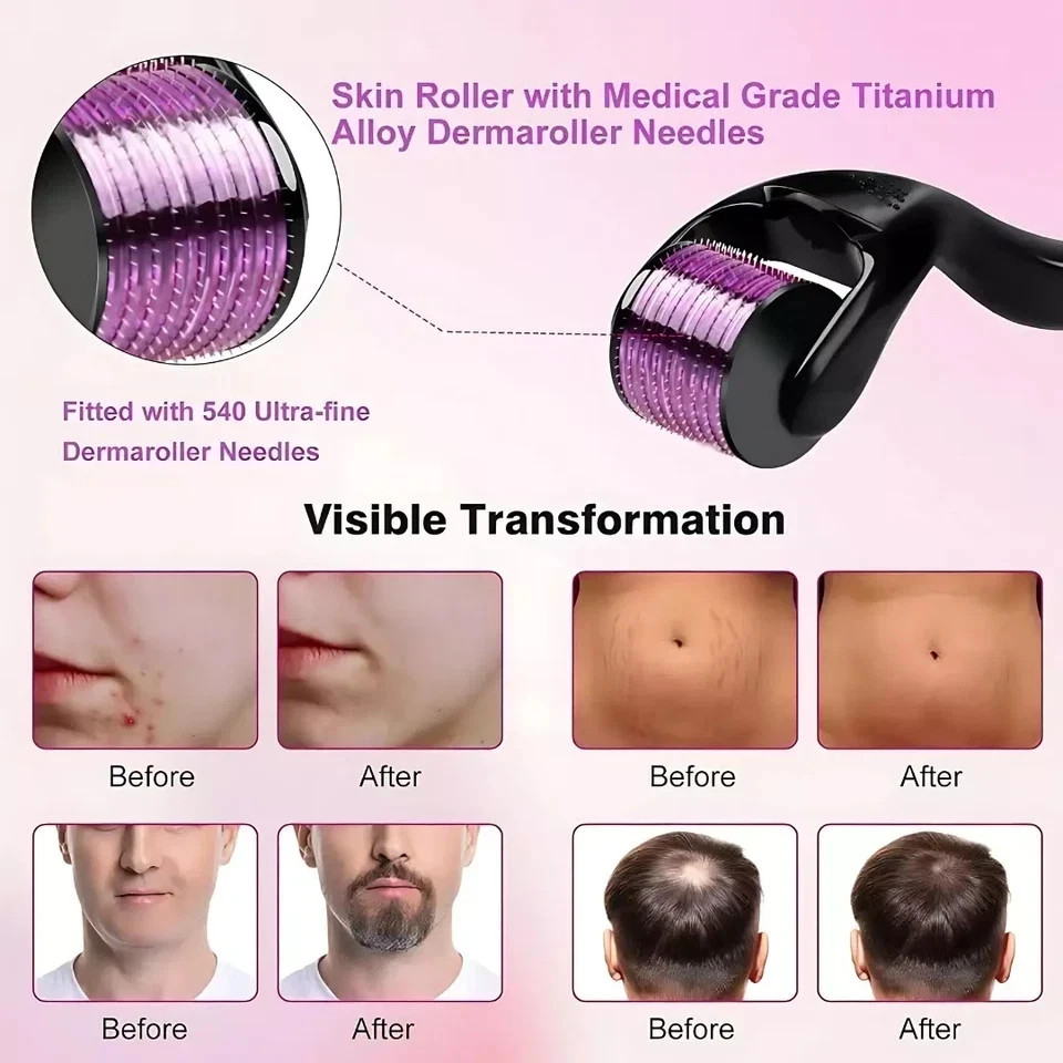 0.5mm 1mm 1.5mm 2.0mm 540 Microneedle Scar Derma Roller Dermaroller