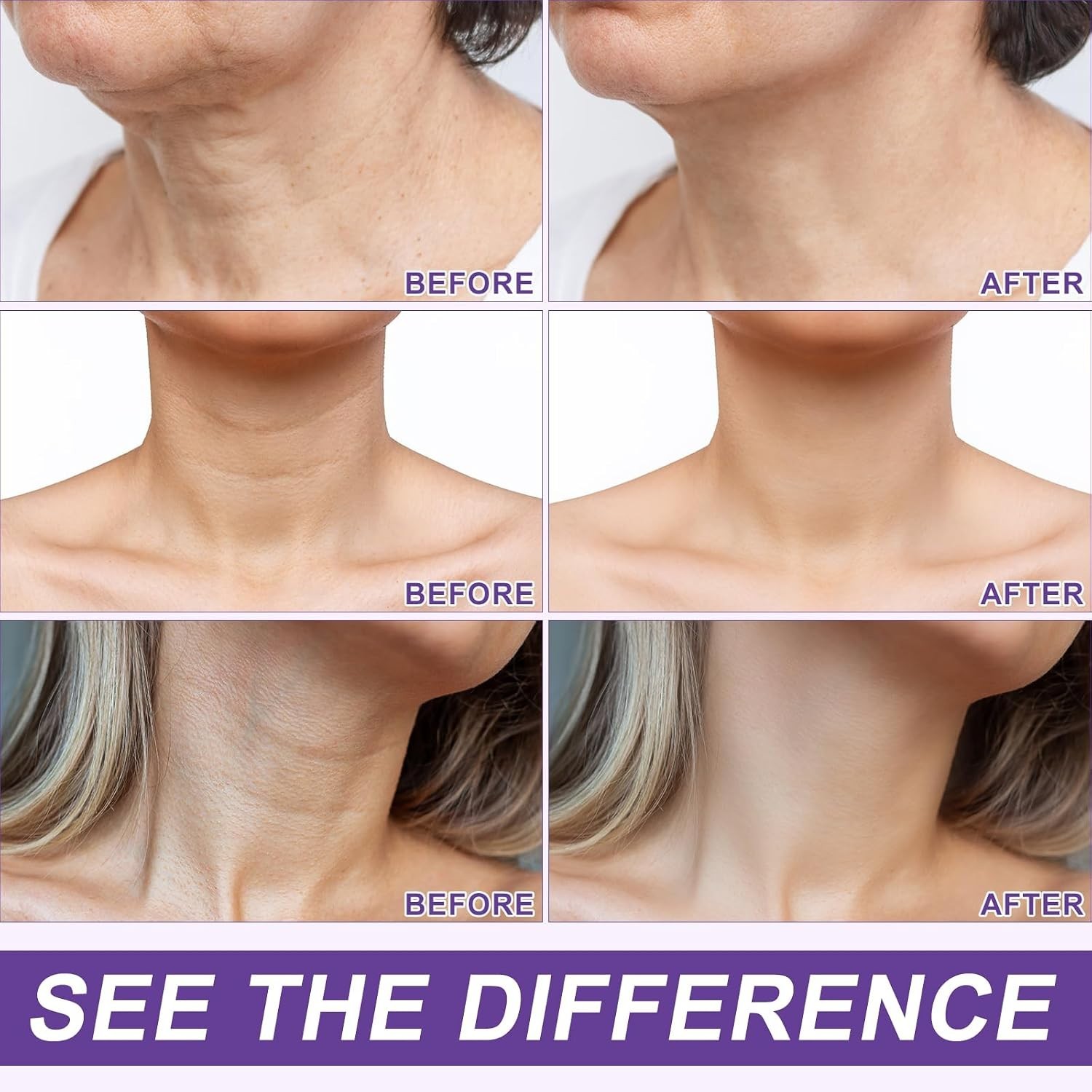 Advanced Neck Firming Cream 4.23Oz – Reduces Wrinkles with Roller Massage Design