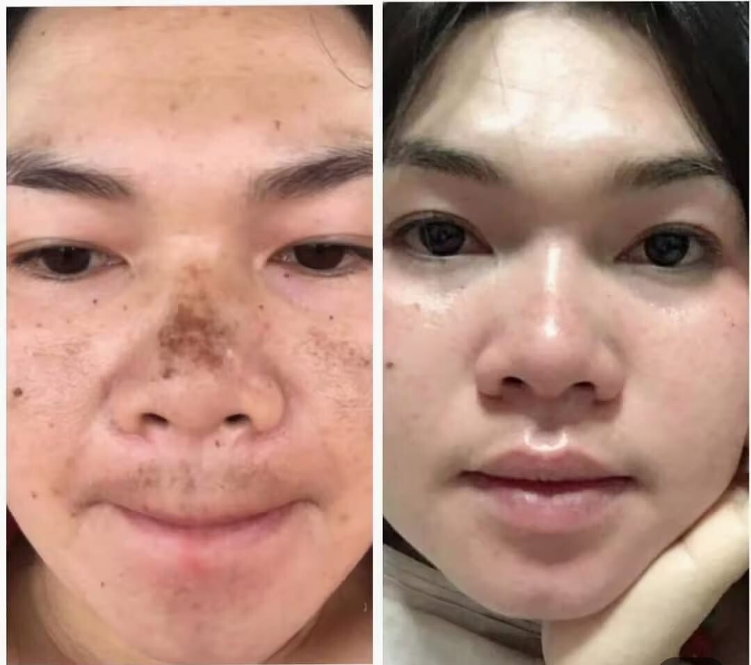 1 SET KIMCHI (EXP: 10/25,01/26) FACECREAM 30 DAYS PLUS + SUN SCREEN SPF50 PA+++
