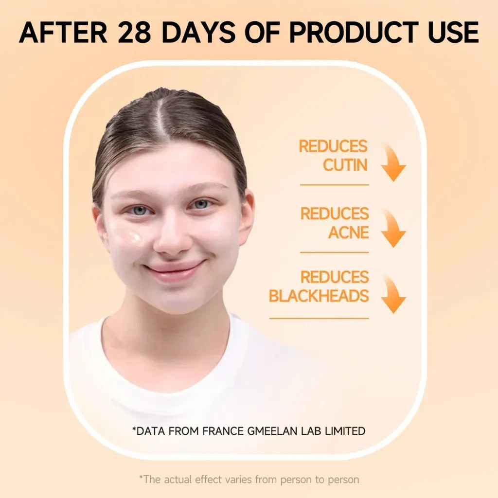Gmeelan Orange Enzymes Exfoliating Brightening Gel 50g – LF16-35(EXP DATE: 2028)