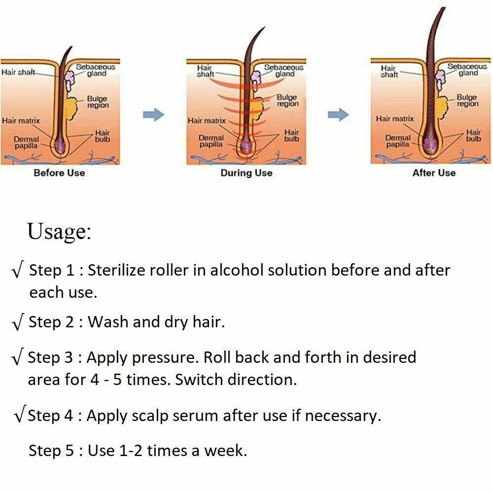 0.5MM-2.0MM Hair Regrowth Micro-Needling Roller Stimulates Hair Growth Painless