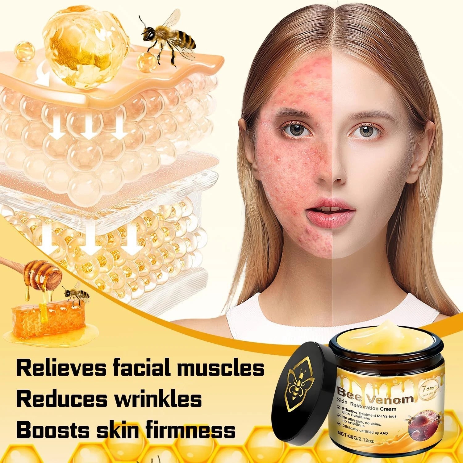 2PCS Bee Venom Skin Restoration Cream, Bee Venom Skin Treatment Cream, Effective