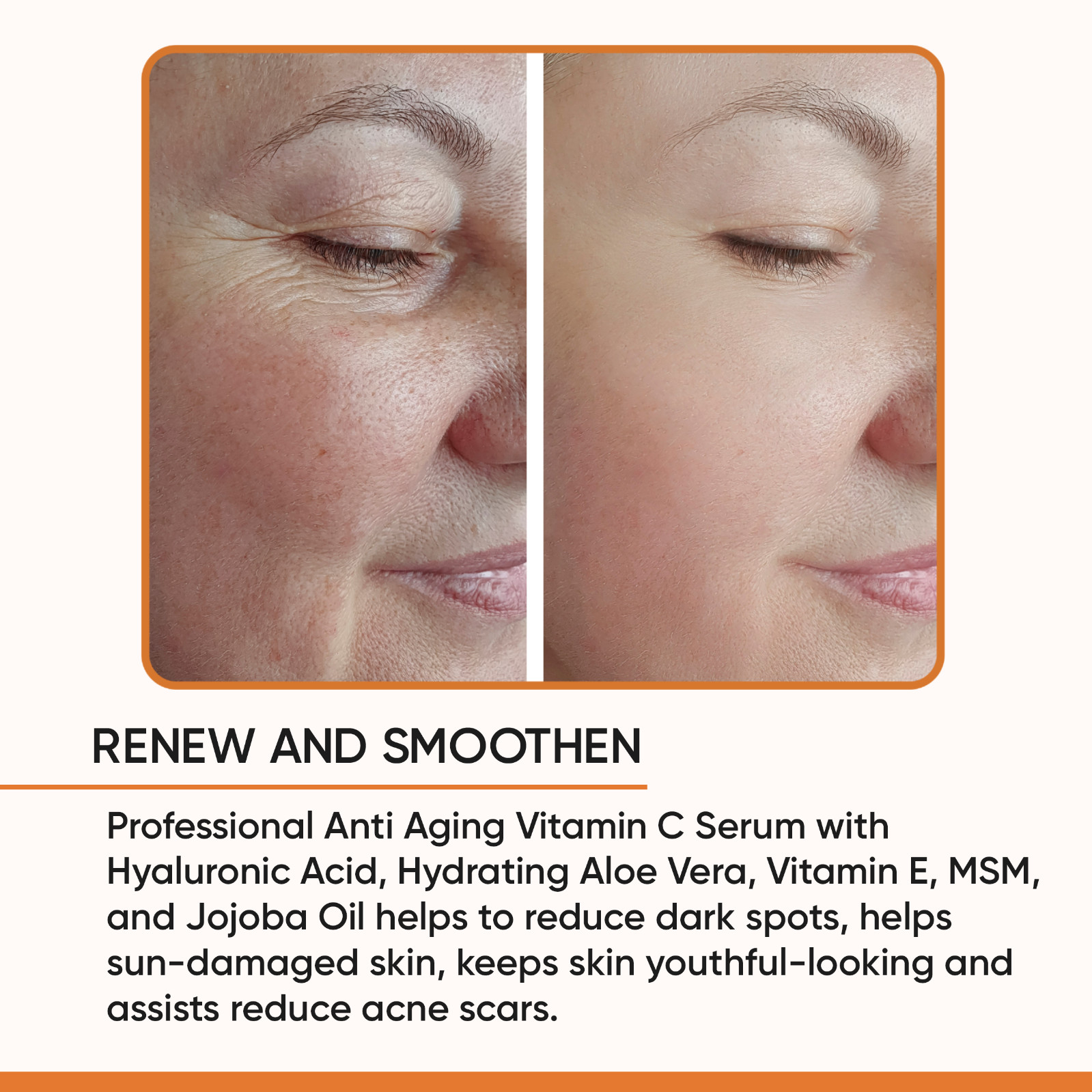 100% PURE VITAMIN C SERUM FOR FACE, Anti Aging Serum with Hyaluronic Acid (2 OZ)