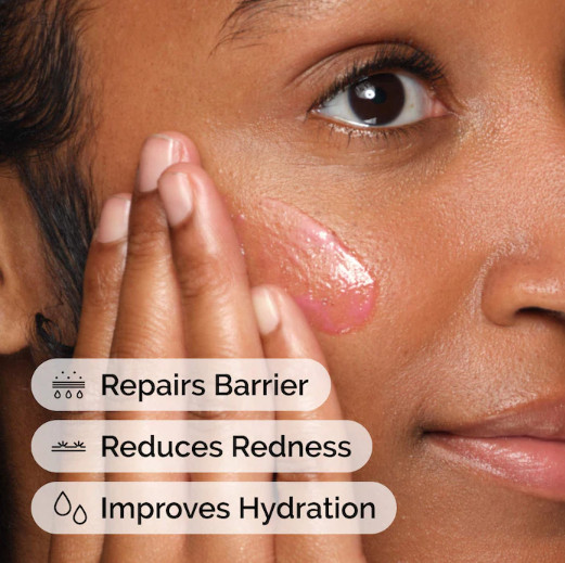 The Ordinary Soothing Barrier Support Serum for Sensitive Skin Hydration,1 oz