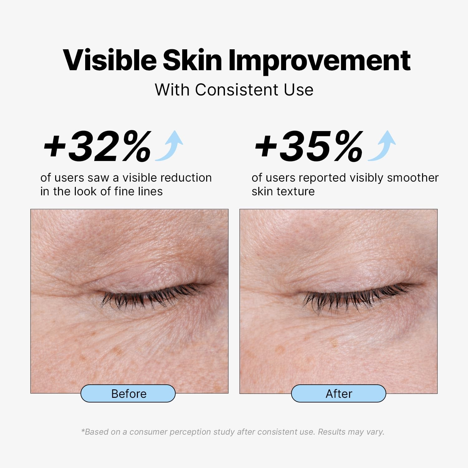 Retinol Moisturizer Anti Aging Wrinkle Cream for Women Men Collagen Boost