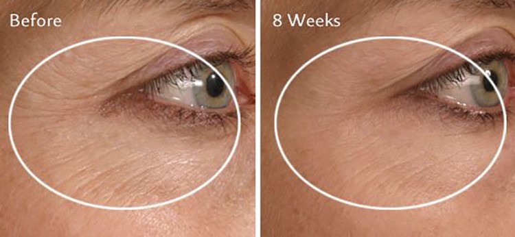Collagen Booster Serum Peptides CoEnzyme CoQ10 Matrixyl 3000 Hyaluronic Acid HA