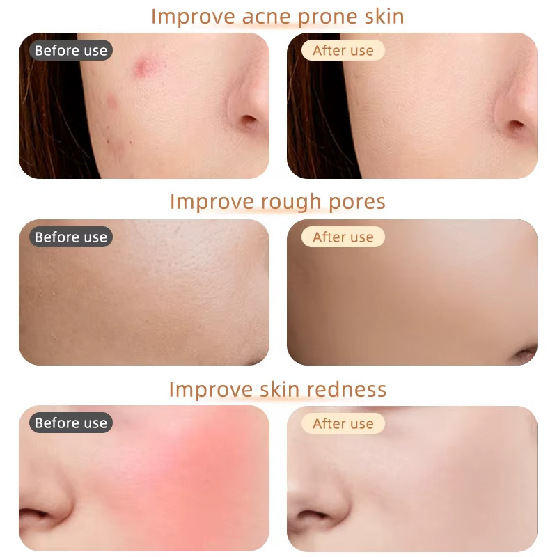 Red Light Therapy LED Face Mask Skin Care Anti Wrinkles Acne Reduction Rose Gold