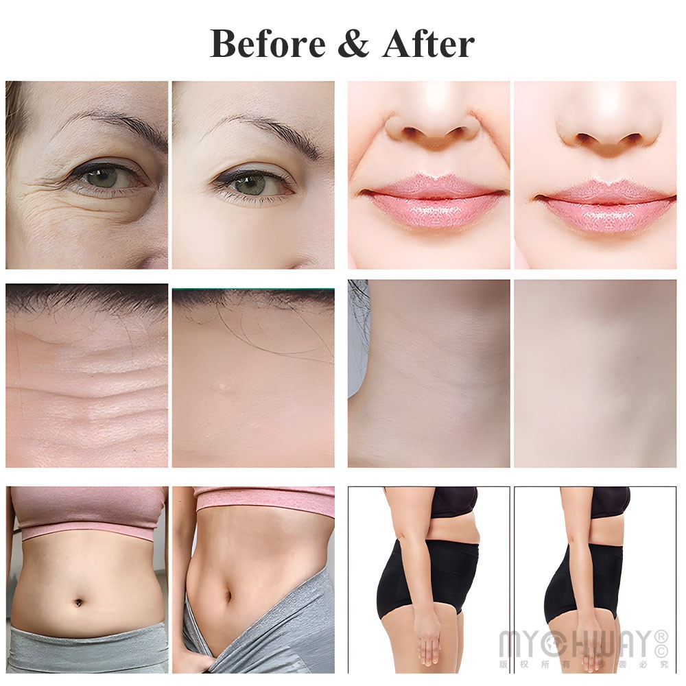 7D Facial Eye Care Beauty Machine for Taut Skin Enhance Body Curves Anti Aging
