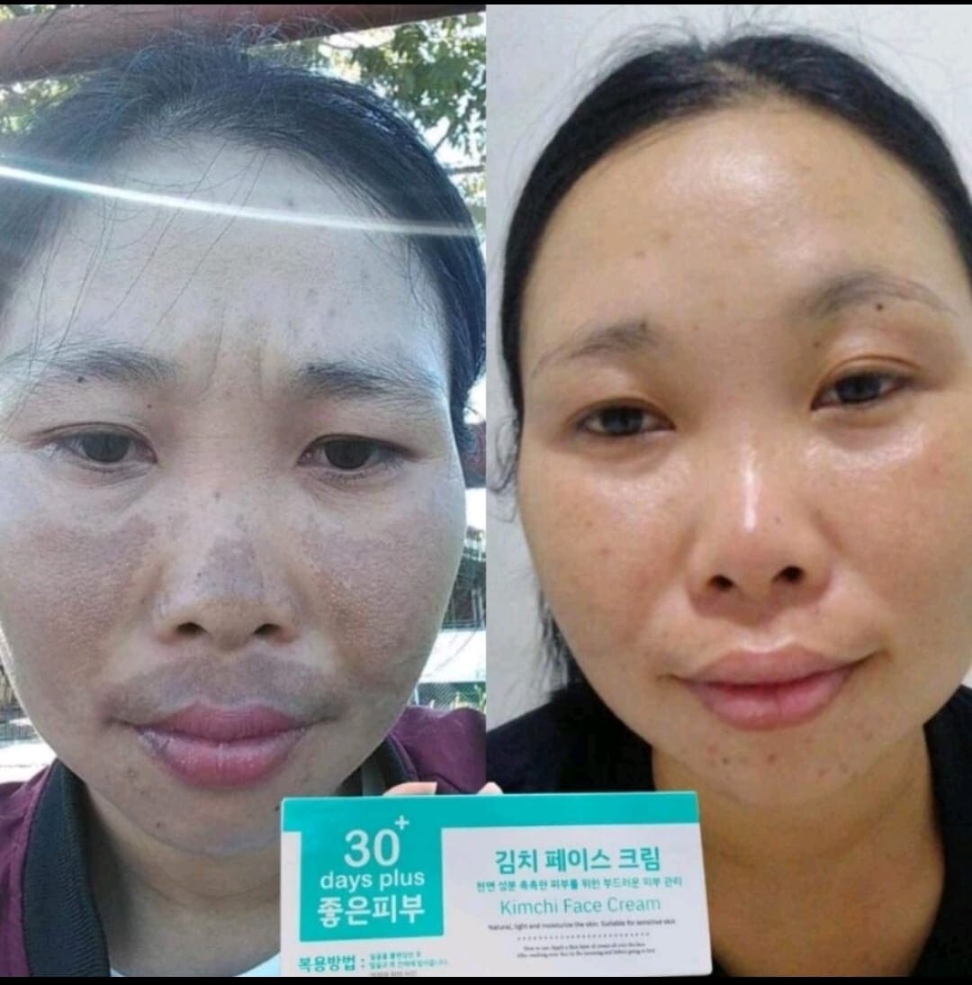 1 SET KIMCHI (EXP: 10/25,01/26) FACECREAM 30 DAYS PLUS + SUN SCREEN SPF50 PA+++