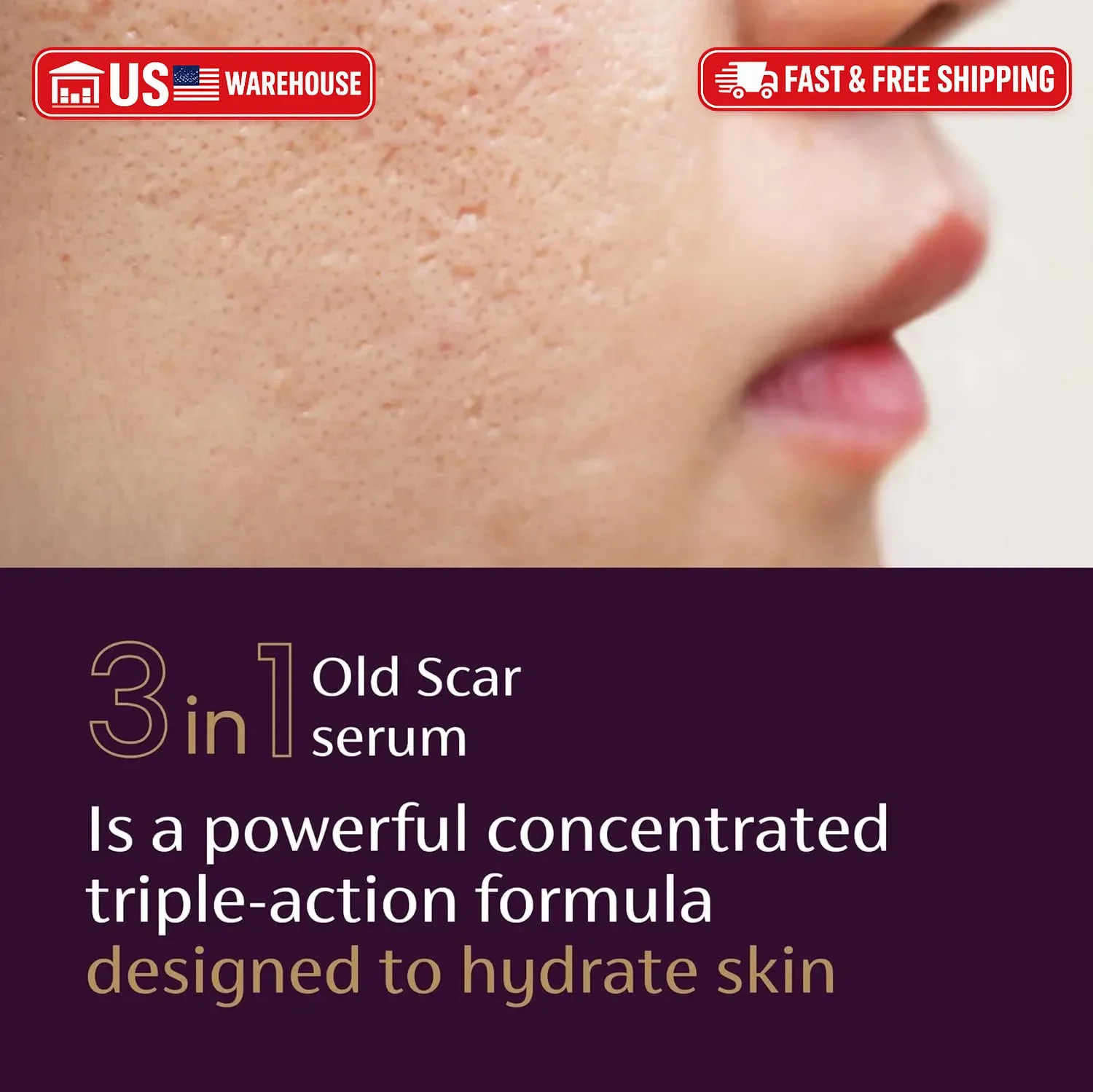 Mederma Scar Serum – Triple-Action Formula with Vitamin E, Hyaluronic Acid & Nia