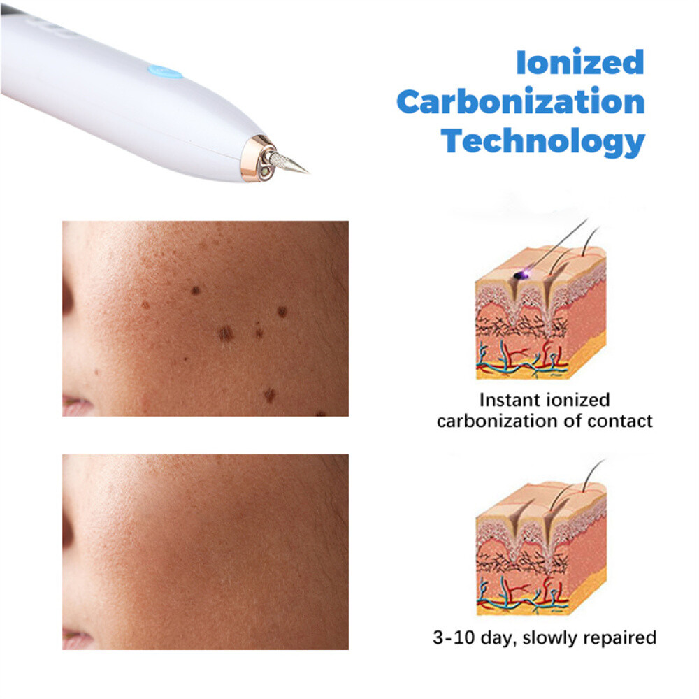Laser Plasma Pen Tattoo Mole Freckle Spot Mole Removal Skin Tag Wart Remover Pen