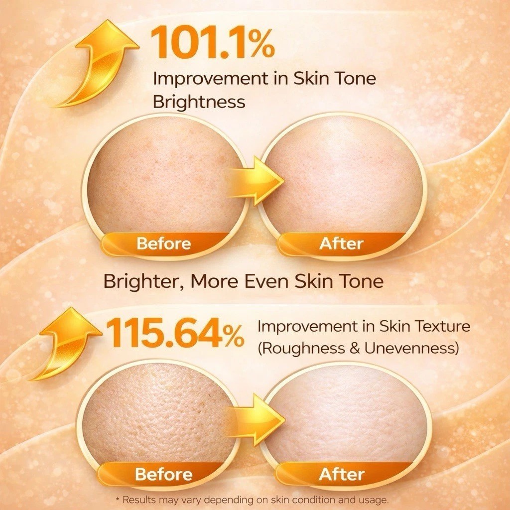Kojic Acid & Turmeric Body Spray – Exfoliates, Brightens & Smooths Skin, 200ml
