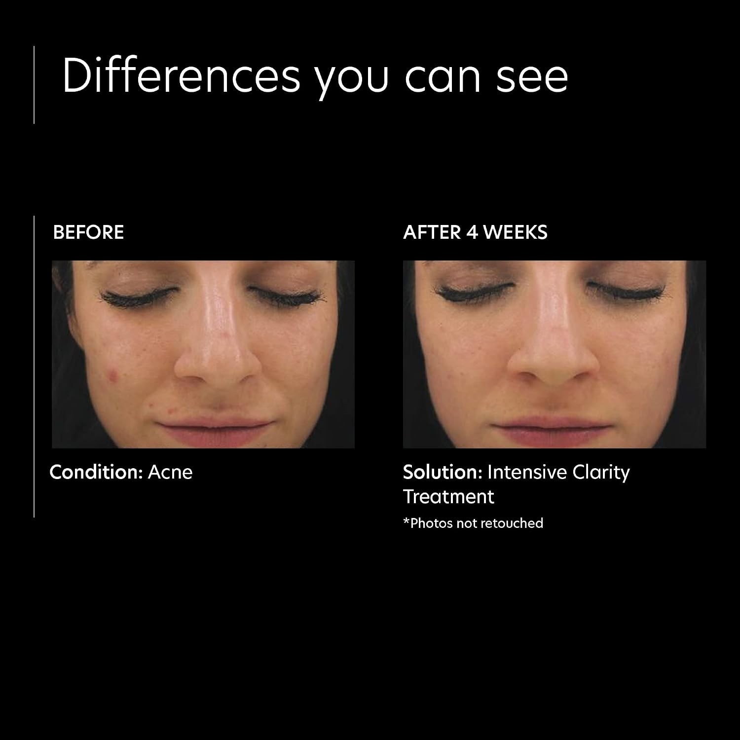 2 PIECE KIT PCA SKIN Intensive Anti Aging Retinol Serum, 0.1% Pure Retinol