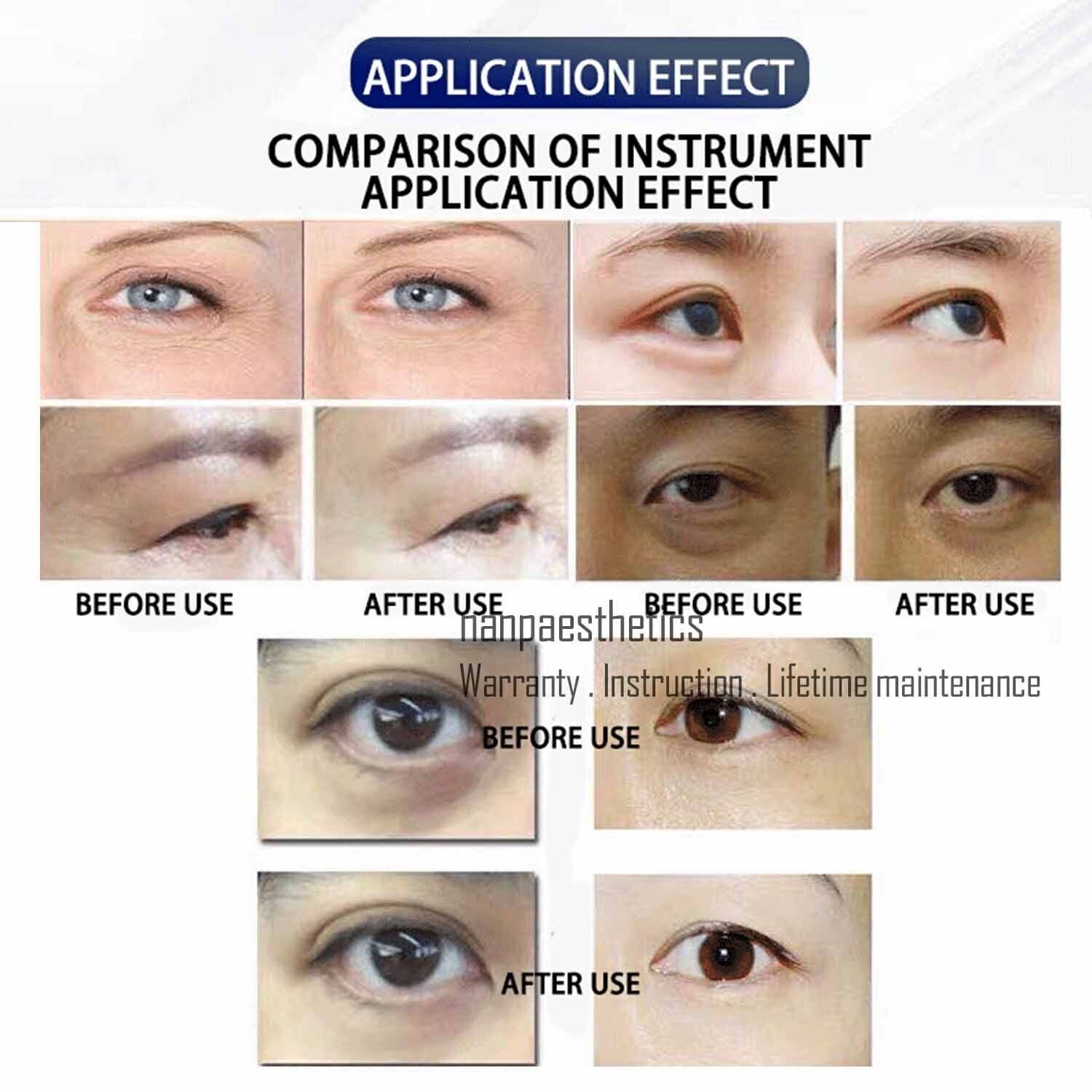 2 Handles RF Eye Face Body Wrinkle Lift Machine Anti aging Facial Skin Lifting