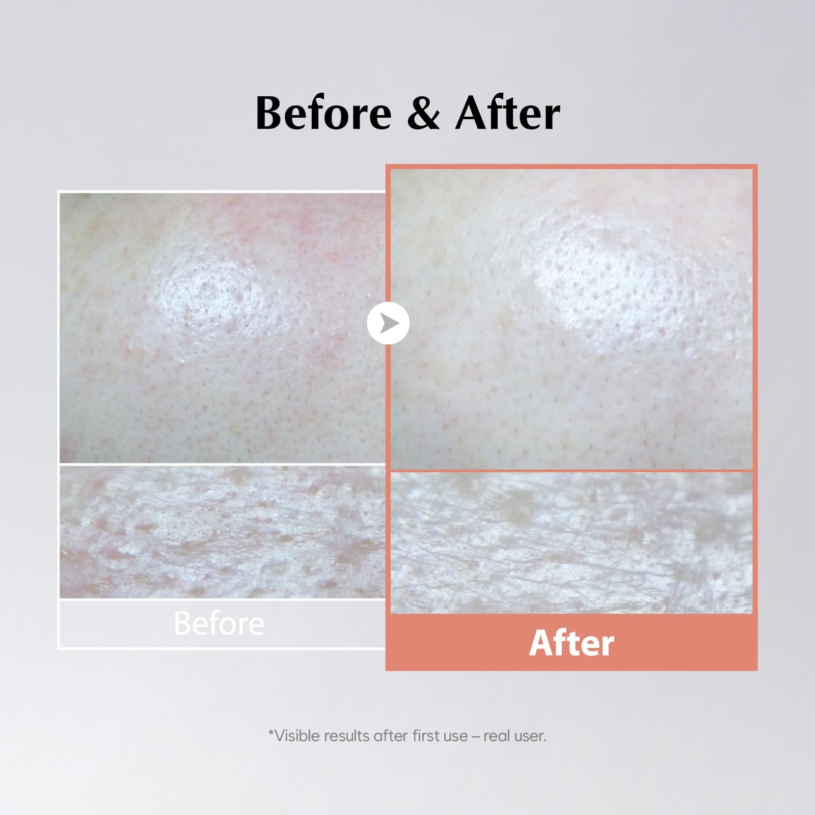 VITA VITALIZING , 3.38fl.oz/100ml,Hydrating, Jelly Texture, Glow-Enhancing, M…