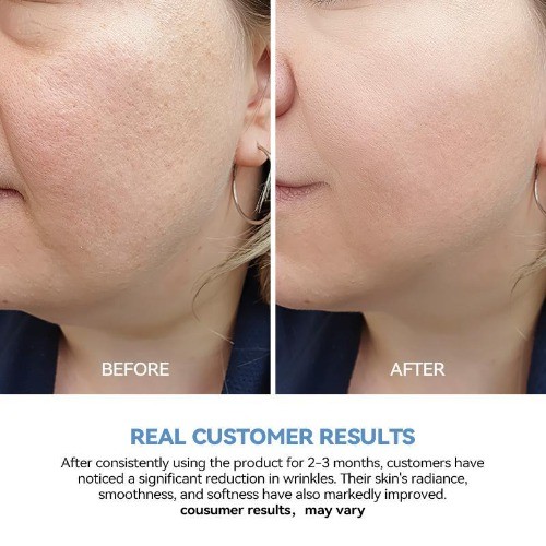 Noix De Coco 5% Hyaluronic Acid Serum, Ultra-Hydrating Vials (30PCS)