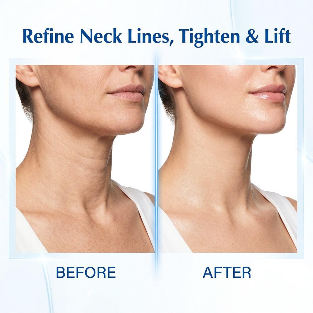 5PCS Magec Collagen Fullerene Neck Cream – Neck Skincare with Collagen