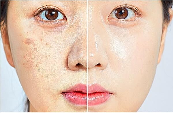 PLLA (10,000ppm) + (15%) PDRN & Glutathione (liposome) Cell Regation Ampoule