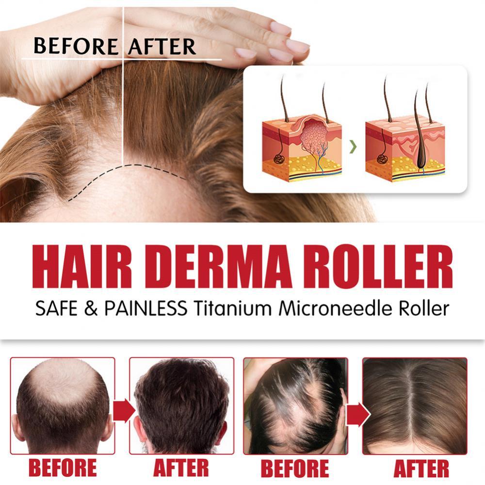 Beard and Hair Growth Derma Roller 0.5mm Titanium Derma Roller USA Fast Shipping