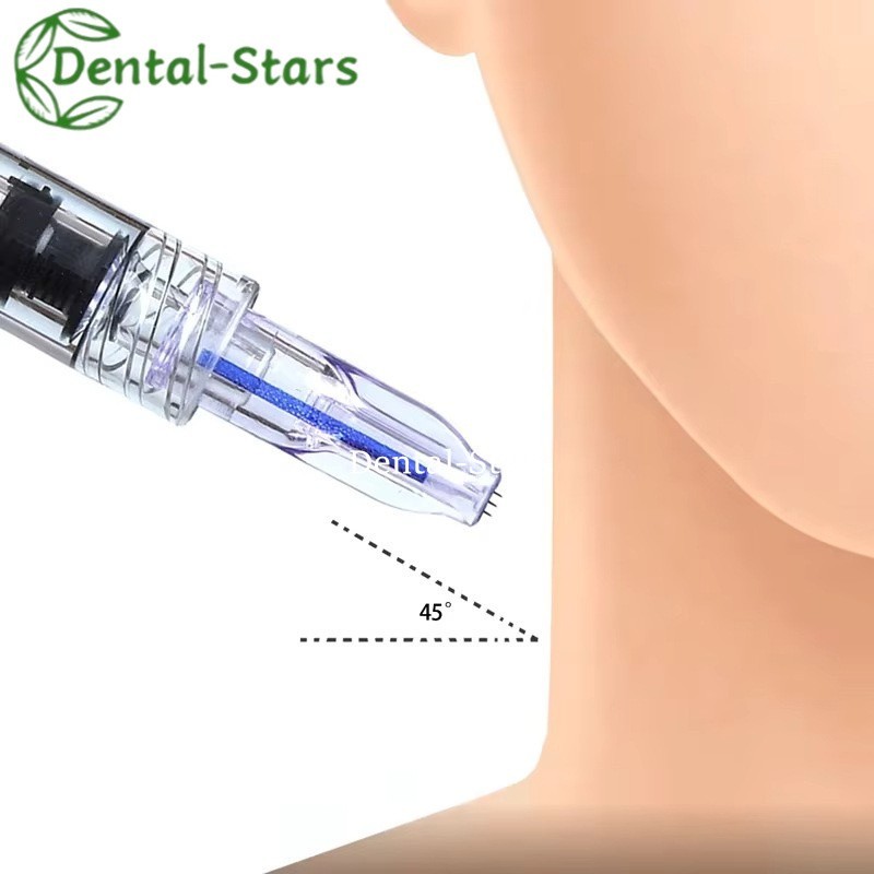 Nanosoft Microneedle 3 Pins 34G Micro needle For Eyes Face Skin Care 1Pcs/Pack