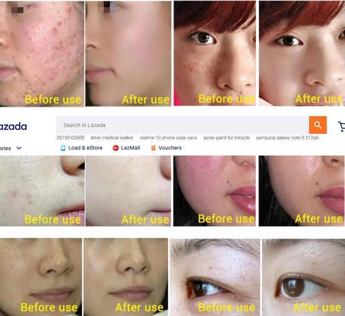 Senana Niacinamide Ampoule 7-Piece Serum Skin Whitening, Hydratting Anti-Aging