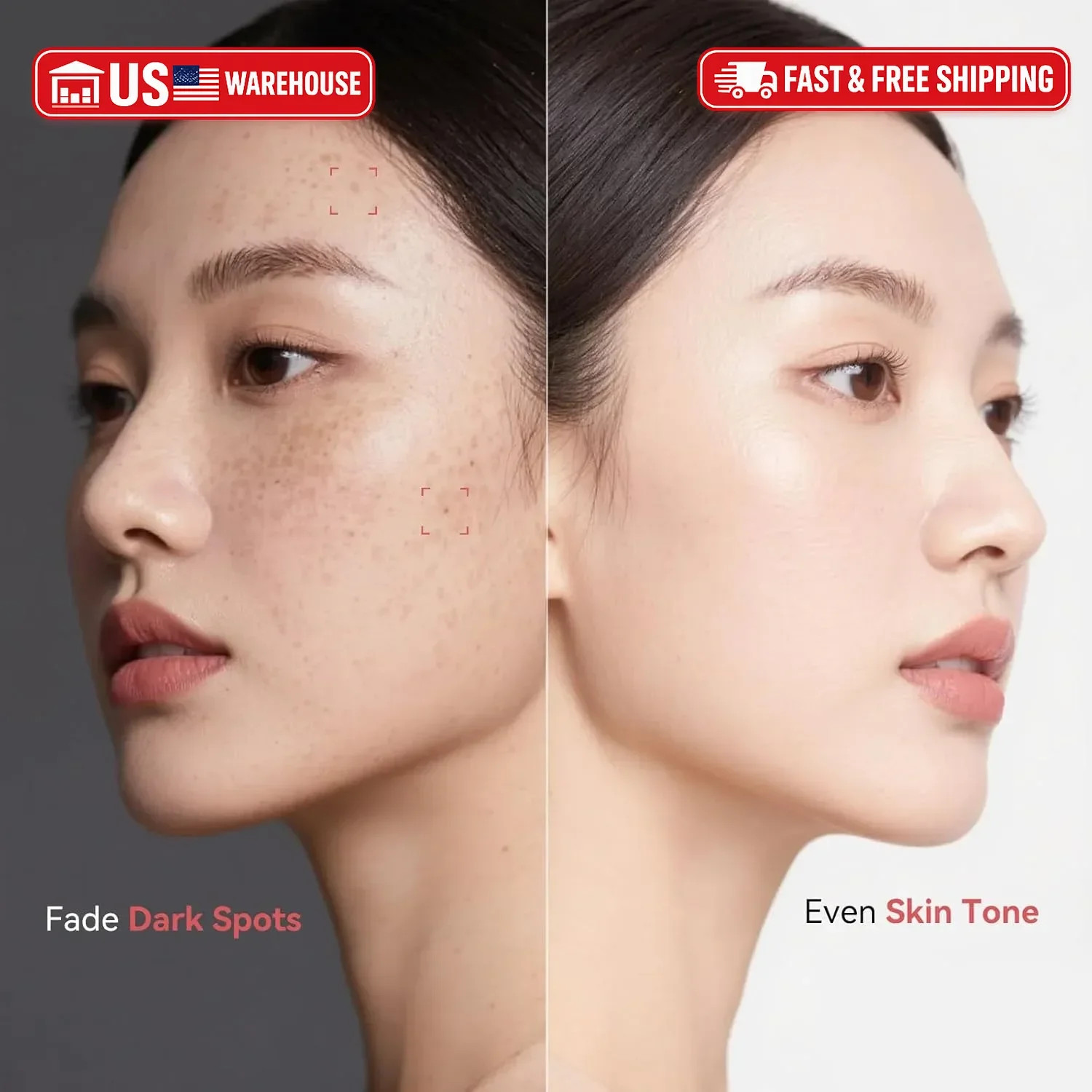 Dark Spot Remover for Face and Body – Dark Spot Corrector Serum for Age Spots Su