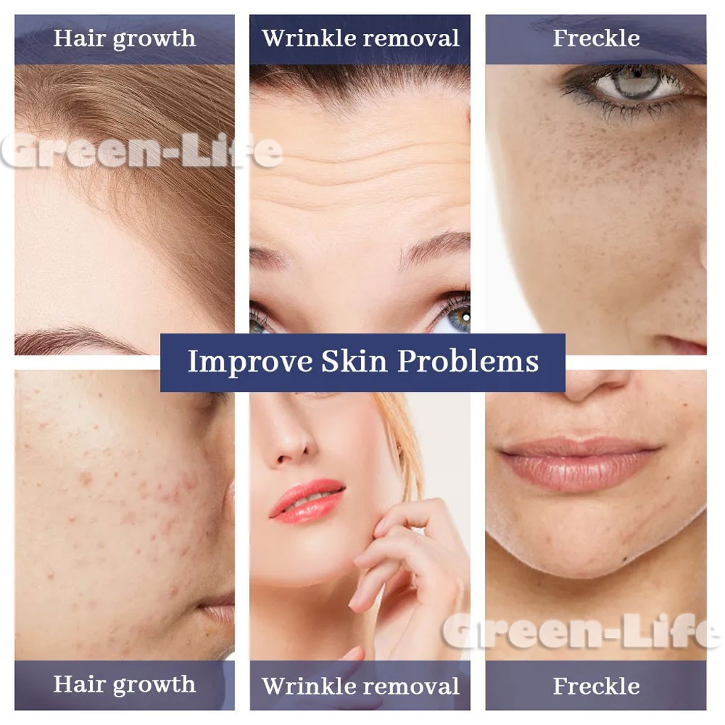 Micro Pen Wrinkle Removal Skin Rejuvenation Machine with 10x 9/12/24/42Pins Nano