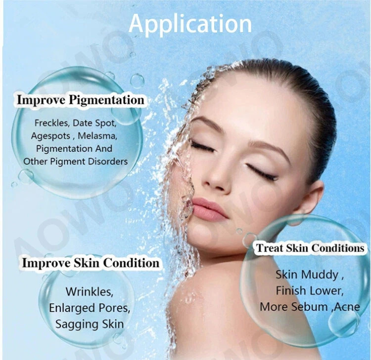 5 Pin Crystal Multi-Tips Replace Needle For Beauty Facial Skin Care Tool 1.5mm