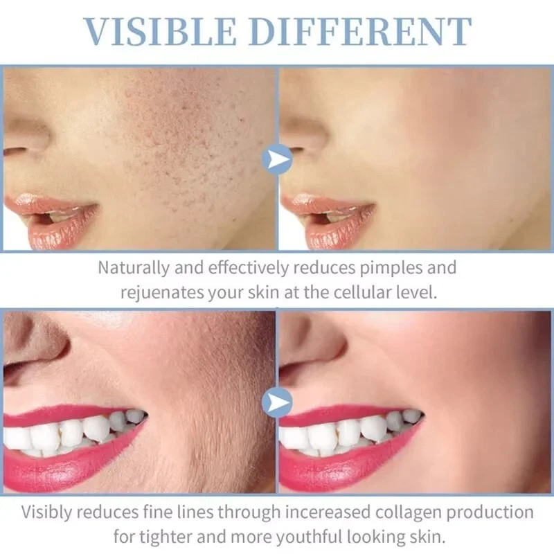 Multifunction Facial Machine Skin Therapy Wand Anti Aging-Wrinkle Treatment US