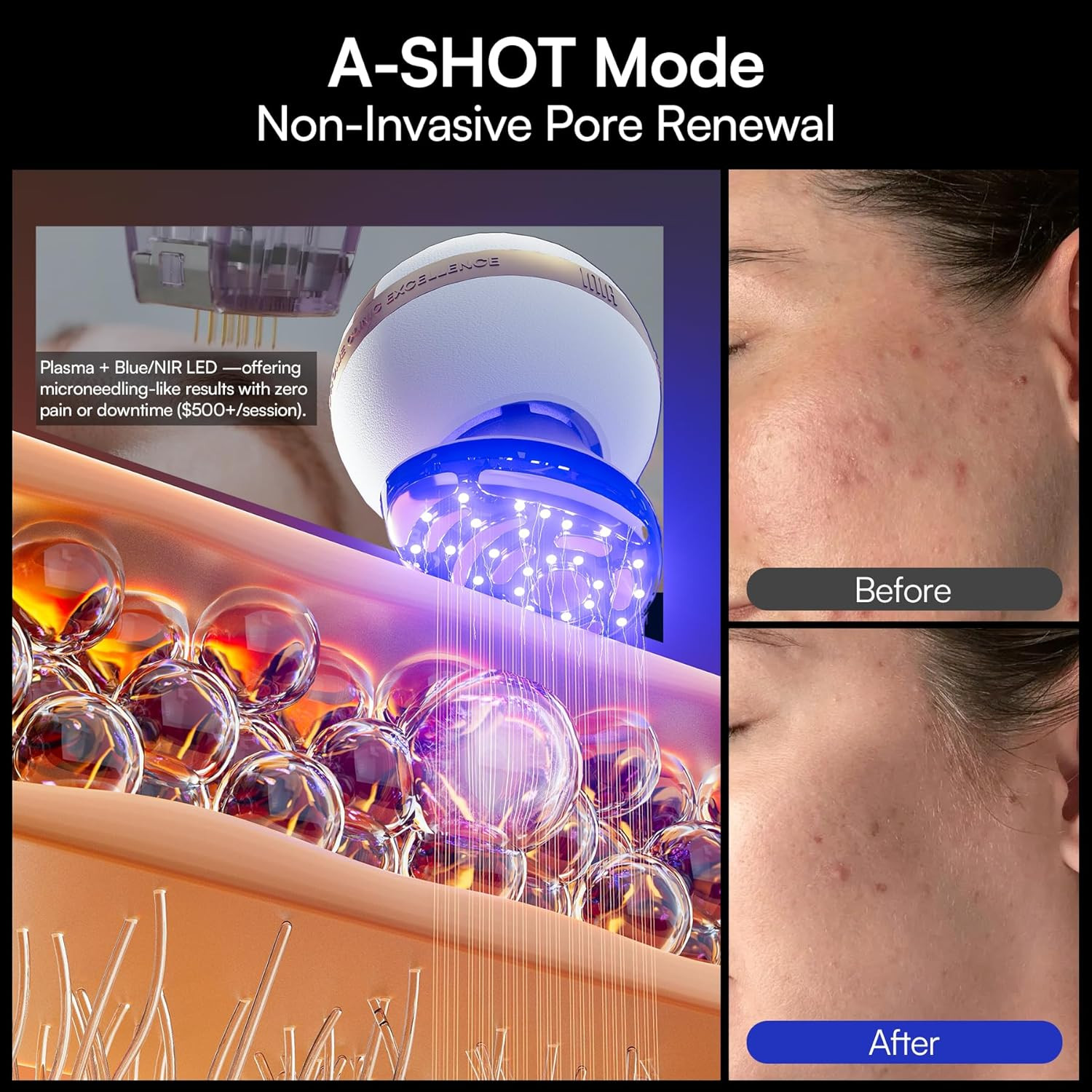 SPHERA Upgraded 8-In-1 Microcurrent Facial Device for Face & Neck – Red Light, T