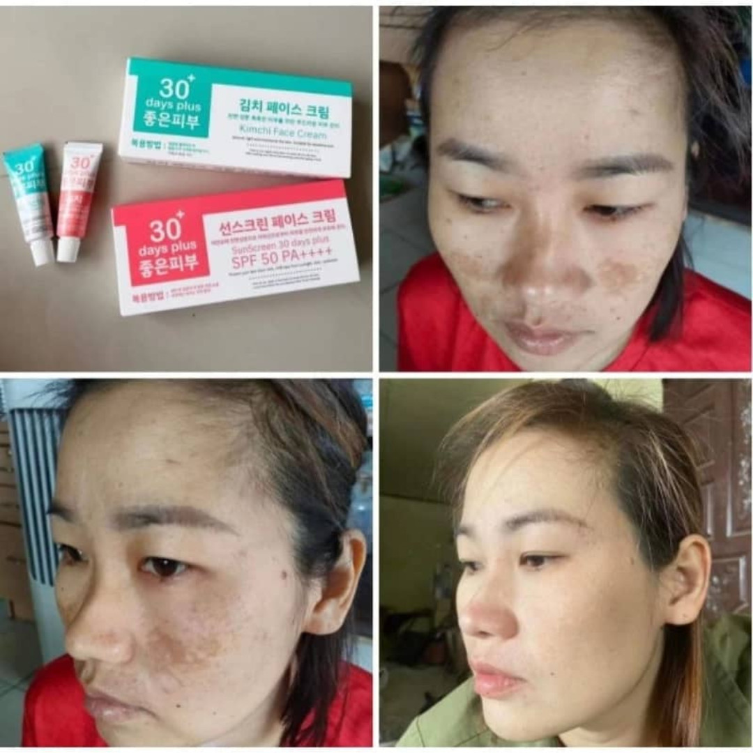1 SET KIMCHI FACECREAM 30 DAYS PLUS + SUN SCREEN SPF50 PA+++
