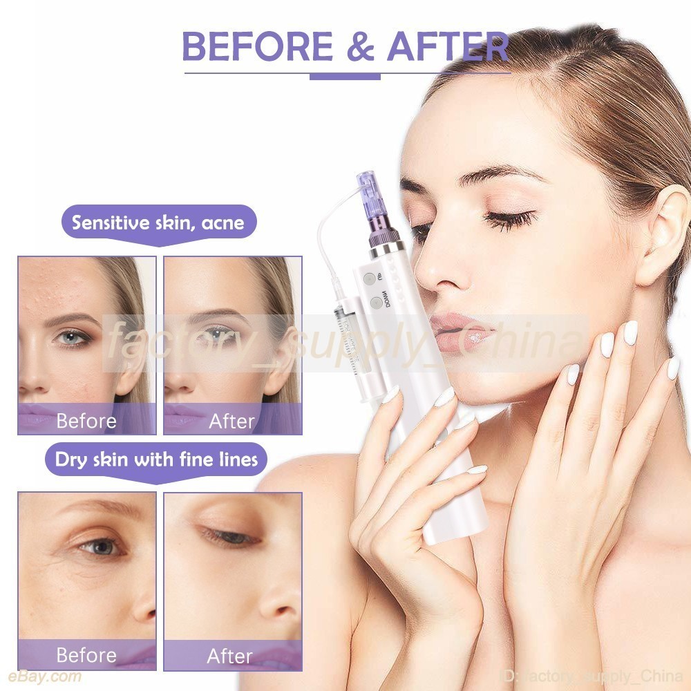 New 10Pcs 12/36/42/Nano Pin Replace Cartridges For Anti-Wrinkle Beauty Equipment