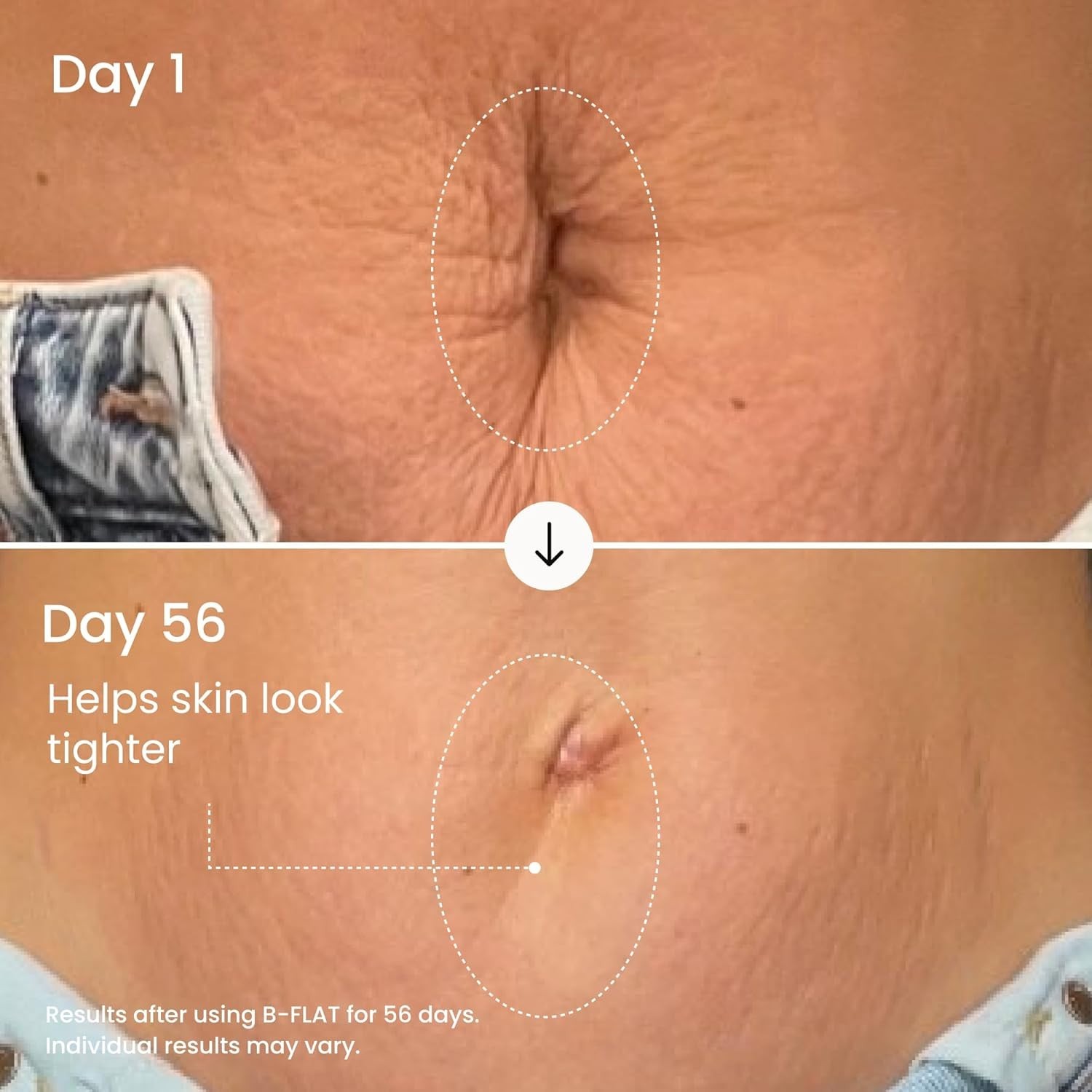 Clinically Proven Stretch Mark Cream for Women – 3.38 Fl Oz