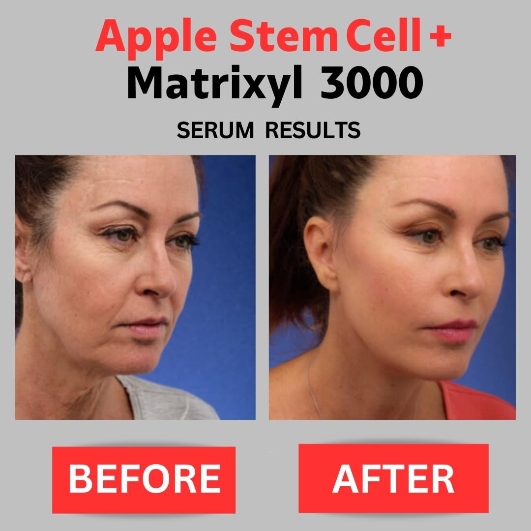 Apple Stem Cell + Matrixyl 3000 Serum With Hyaluronic Acid, Peptide Serum, Anti-
