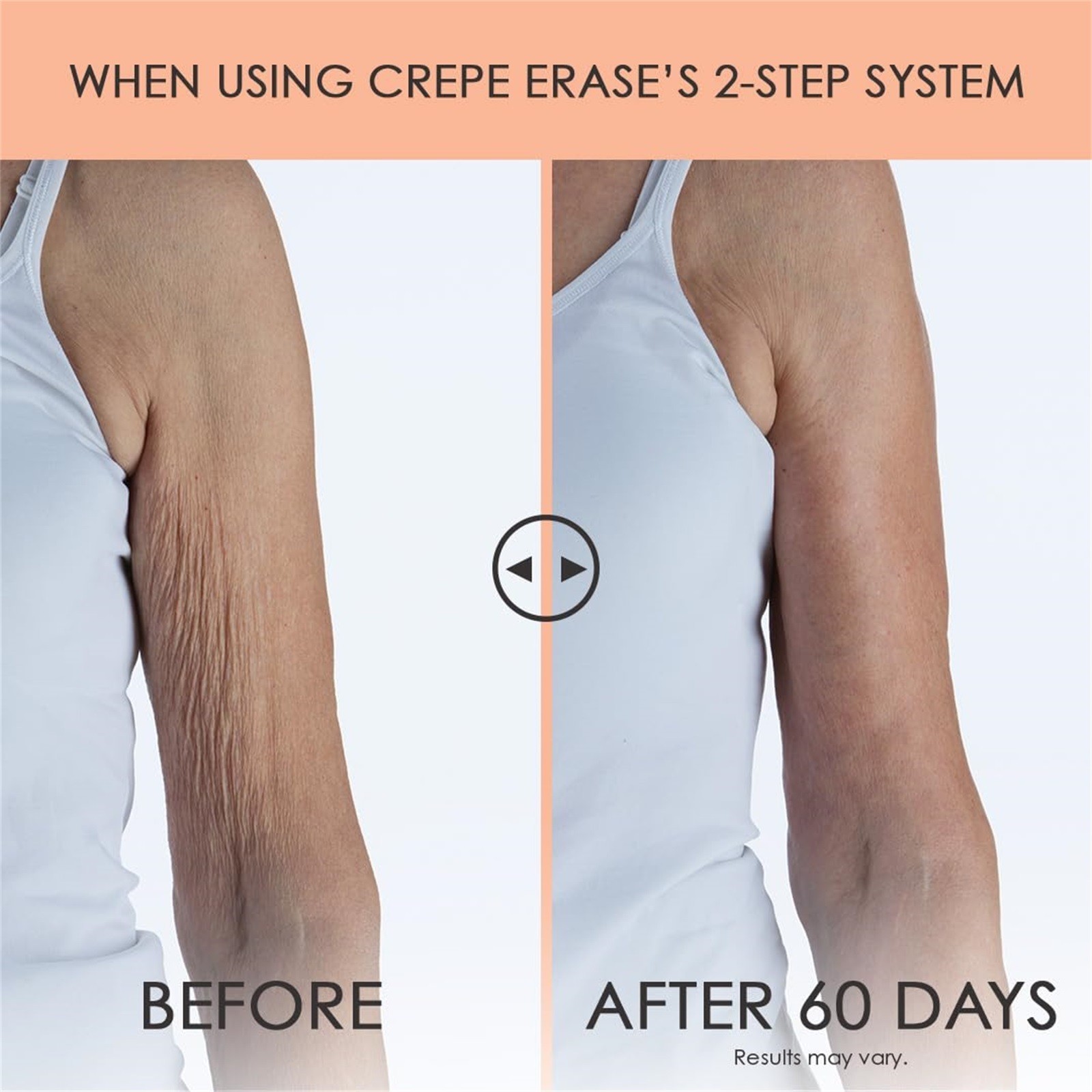 High-Quality Crepe Erase Advanced Body Repair Treatment 285g 10oz Face Body Balm