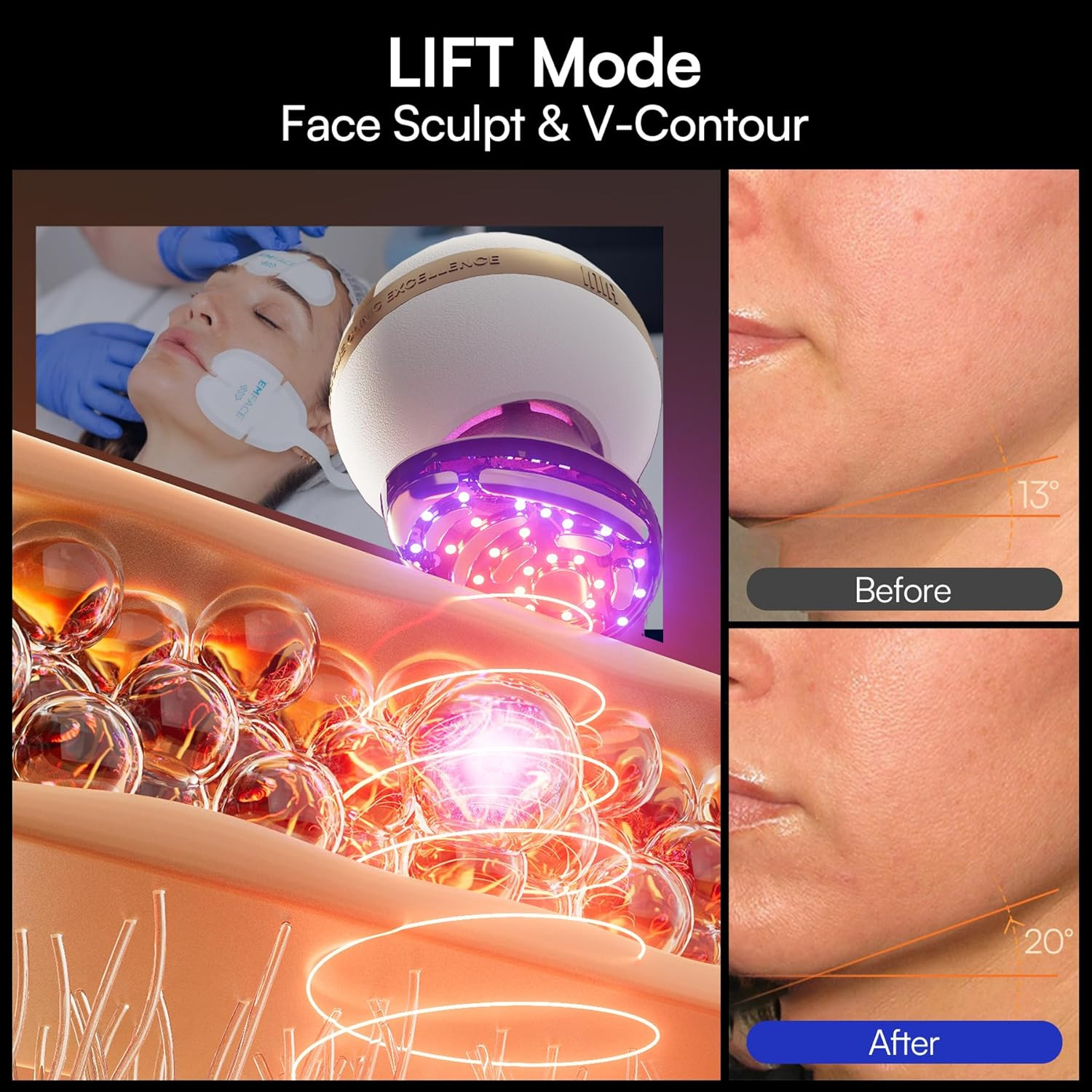 SPHERA Upgraded 8-In-1 Microcurrent Facial Device for Face & Neck – Red Light, T