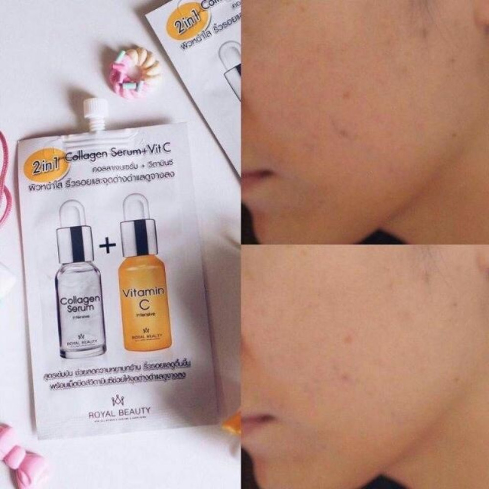 New year set Royal Collagen Serum + Vit C 2 in 1, Collagen Orange 1 box 6 packet