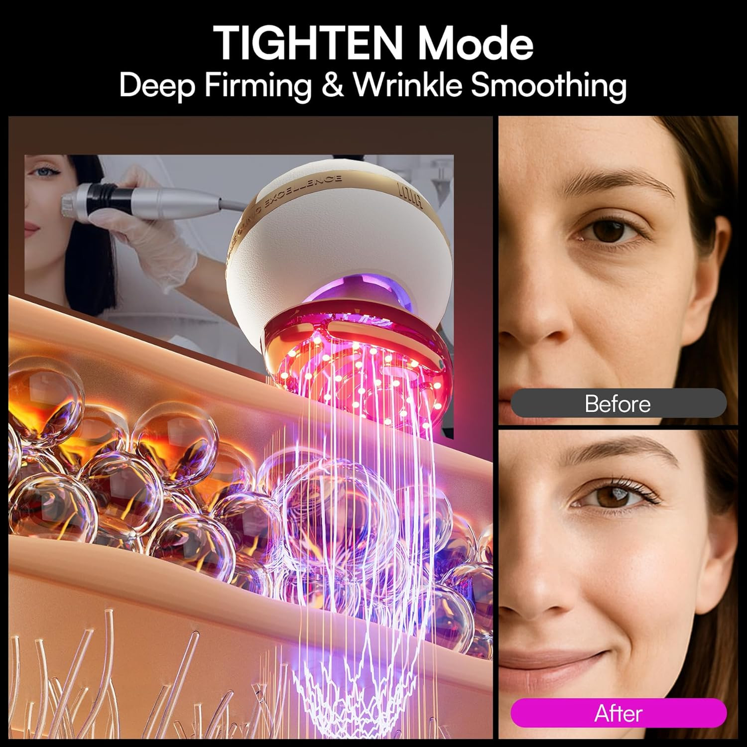SPHERA Upgraded 8-In-1 Microcurrent Facial Device for Face & Neck – Red Light, T
